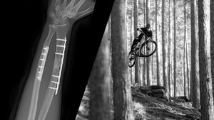 Back in the Saddle – Why Giving Up Was Never an Option by Jonas Salamon